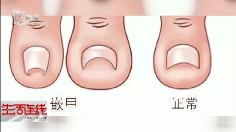 武進(jìn)新聞